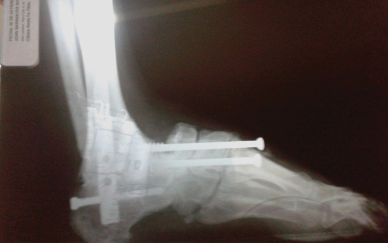 X-Rays-john-barrantes